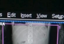 Denúncia de erro médico em Casimiro de Abreu expõe fragilidades na saúde pública do município